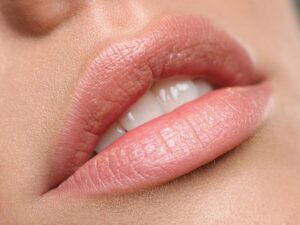 ماندگاری فیلر لب چند ماه است؟