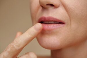 عوارض فیلر لب