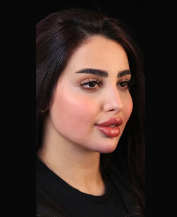 قبل